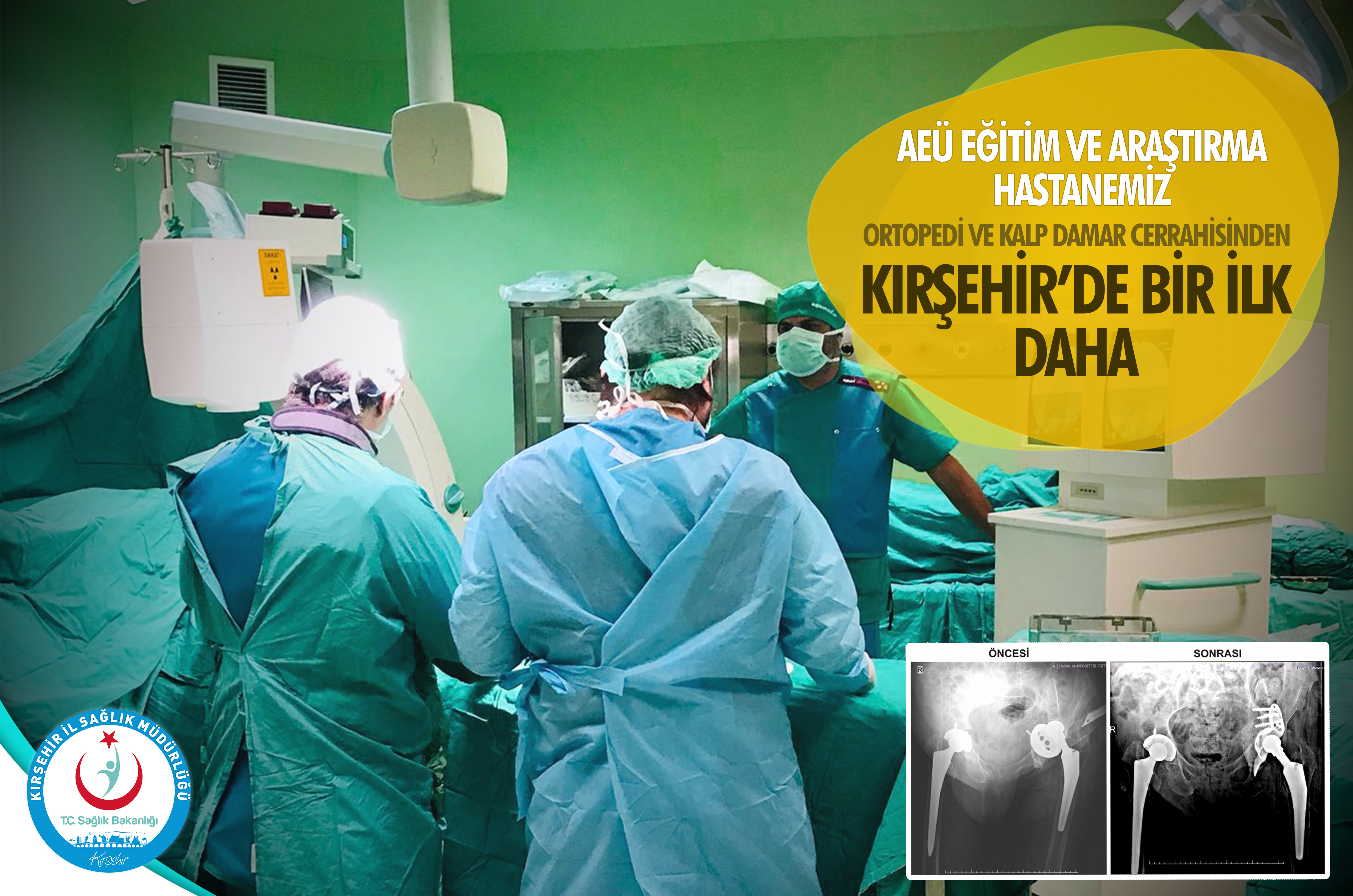 Kırşehir’de; “sağlıkta Bir İlk” Daha…